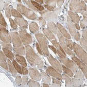 Anti-KIF1C antibody produced in rabbit Prestige Antibodies® Powered by Atlas Antibodies, affinity isolated antibody, buffered aqueous glycerol solution, Ab2