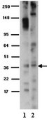 Anti-Opioid Receptor Antibody, µ, pain serum, Chemicon®