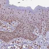Anti-CABIN1 antibody produced in rabbit Prestige Antibodies® Powered by Atlas Antibodies, affinity isolated antibody, buffered aqueous glycerol solution