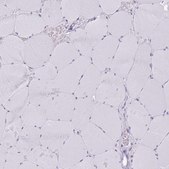 Anti-SLC6A1 antibody produced in rabbit Prestige Antibodies® Powered by Atlas Antibodies, affinity isolated antibody, buffered aqueous glycerol solution