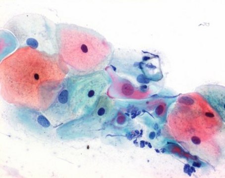Disolución de Papanicolaou&#8242;s 3b disolución policromática EA 50 for cytology