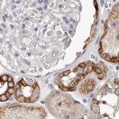 Anti-MRPL18 antibody produced in rabbit Prestige Antibodies® Powered by Atlas Antibodies, affinity isolated antibody, buffered aqueous glycerol solution, ab2