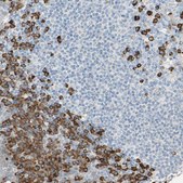 Anti-PLCXD1 antibody produced in rabbit Prestige Antibodies® Powered by Atlas Antibodies, affinity isolated antibody, buffered aqueous glycerol solution