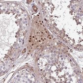 Anti-TRIP6 antibody produced in rabbit Prestige Antibodies® Powered by Atlas Antibodies, affinity isolated antibody, buffered aqueous glycerol solution