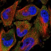 Anti-TAL2 antibody produced in rabbit Prestige Antibodies® Powered by Atlas Antibodies, affinity isolated antibody, buffered aqueous glycerol solution