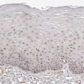 Anti-SOX4 antibody produced in rabbit Prestige Antibodies® Powered by Atlas Antibodies, affinity isolated antibody, buffered aqueous glycerol solution