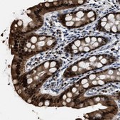 Anti-NSUN5 antibody produced in rabbit Prestige Antibodies® Powered by Atlas Antibodies, affinity isolated antibody, buffered aqueous glycerol solution
