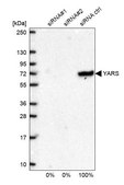 Anti-YARS antibody produced in rabbit Prestige Antibodies® Powered by Atlas Antibodies, affinity isolated antibody, buffered aqueous glycerol solution