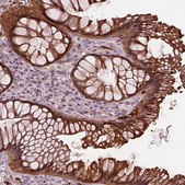 Anti-SRI antibody produced in rabbit Prestige Antibodies® Powered by Atlas Antibodies, affinity isolated antibody