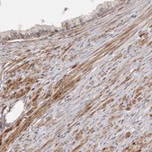 Anti-ADAMTS2 antibody produced in rabbit Prestige Antibodies® Powered by Atlas Antibodies, affinity isolated antibody, buffered aqueous glycerol solution