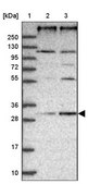 Anti-REEP4 antibody produced in rabbit Prestige Antibodies® Powered by Atlas Antibodies, affinity isolated antibody, buffered aqueous glycerol solution