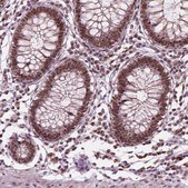 Anti-POLR2E antibody produced in rabbit Prestige Antibodies® Powered by Atlas Antibodies, affinity isolated antibody, buffered aqueous glycerol solution