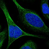 Anti-TCTN3 antibody produced in rabbit Prestige Antibodies® Powered by Atlas Antibodies, affinity isolated antibody, buffered aqueous glycerol solution