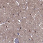 Anti-ERC2 Prestige Antibodies® Powered by Atlas Antibodies, affinity isolated antibody