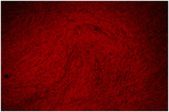 Alizarin-Red Staining Solution Alizarin red is a commonly used stain to identify calcium containing osteocytes in differentiated culture of both human and rodent mesenchymal stem cells (MSCs).