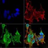 Monoclonal Anti-Gaba-B Receptor 2 - Hrp antibody produced in mouse clone S81-2, purified immunoglobulin