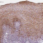 Anti-PI3 antibody produced in rabbit Prestige Antibodies® Powered by Atlas Antibodies, affinity isolated antibody, buffered aqueous glycerol solution