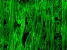 Monoclonal Anti-Dystrophin antibody produced in mouse clone MANDYS8, ascites fluid