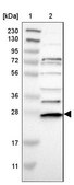 Anti-CDC34 antibody produced in rabbit Prestige Antibodies® Powered by Atlas Antibodies, affinity isolated antibody, buffered aqueous glycerol solution