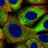 Anti-EIF4B antibody produced in rabbit Prestige Antibodies® Powered by Atlas Antibodies, affinity isolated antibody, buffered aqueous glycerol solution