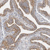 Anti-COA3 antibody produced in rabbit Prestige Antibodies® Powered by Atlas Antibodies, affinity isolated antibody, buffered aqueous glycerol solution
