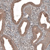 Anti-ZCCHC7 antibody produced in rabbit Prestige Antibodies® Powered by Atlas Antibodies, affinity isolated antibody, buffered aqueous glycerol solution