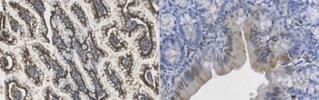 Anti-FABP2 Antibody, clone 4F6.1 clone 4F6.1, from mouse