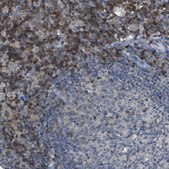 Anti-CAMK4 antibody produced in rabbit affinity isolated antibody, Prestige Antibodies® Powered by Atlas Antibodies, buffered aqueous glycerol solution