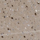 Anti-PSMC5 antibody produced in rabbit Prestige Antibodies® Powered by Atlas Antibodies, affinity isolated antibody, buffered aqueous glycerol solution
