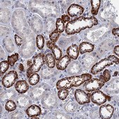 Anti-MARCH3 antibody produced in rabbit Prestige Antibodies® Powered by Atlas Antibodies, affinity isolated antibody, buffered aqueous glycerol solution