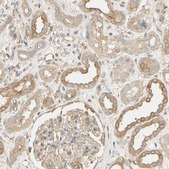 Anti-KCNE4 antibody produced in rabbit Prestige Antibodies® Powered by Atlas Antibodies, affinity isolated antibody, buffered aqueous glycerol solution