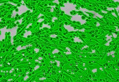 OSUMMER.4 Mouse NRAS-Mutant Melanoma Cell Line