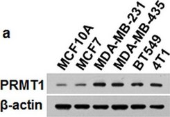 Anti-PRMT1 Antibody Upstate®, from rabbit