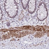 Anti-KCNN4 antibody produced in rabbit Prestige Antibodies® Powered by Atlas Antibodies, affinity isolated antibody, buffered aqueous glycerol solution