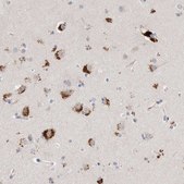 Anti-GGH antibody produced in rabbit Prestige Antibodies® Powered by Atlas Antibodies, affinity isolated antibody, buffered aqueous glycerol solution
