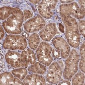 Anti-CLPX antibody produced in rabbit Prestige Antibodies® Powered by Atlas Antibodies, affinity isolated antibody, buffered aqueous glycerol solution