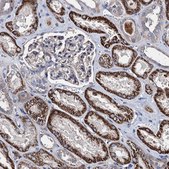 Anti-AKAP11 antibody produced in rabbit Prestige Antibodies® Powered by Atlas Antibodies, affinity isolated antibody, buffered aqueous glycerol solution