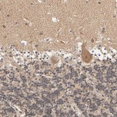 Anti-ARHGEF7 antibody produced in rabbit Prestige Antibodies® Powered by Atlas Antibodies, affinity isolated antibody, buffered aqueous glycerol solution