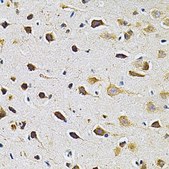 Anti-ADRBK1 antibody produced in rabbit