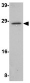 Anti-CIDE-A Antibody from rabbit, purified by affinity chromatography