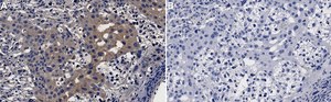 Anti-MAP Kinase 2/Erk2 Antibody, clone 1B9 ZooMAb® Rabbit Monoclonal recombinant, expressed in HEK 293 cells