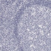 Anti-DNALI1 antibody produced in rabbit Prestige Antibodies® Powered by Atlas Antibodies, affinity isolated antibody, buffered aqueous glycerol solution