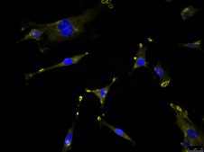 OSUMMER.13 Mouse NRAS-Mutant Melanoma Cell Line