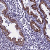 Anti-VDAC2 antibody produced in rabbit Prestige Antibodies® Powered by Atlas Antibodies, affinity isolated antibody, buffered aqueous glycerol solution