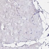 Anti-TFAP2C antibody produced in rabbit Prestige Antibodies® Powered by Atlas Antibodies, affinity isolated antibody, buffered aqueous glycerol solution