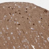 Anti-CAMK2B antibody produced in rabbit Prestige Antibodies® Powered by Atlas Antibodies, affinity isolated antibody, buffered aqueous glycerol solution