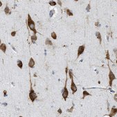 Anti-FXR1 antibody produced in rabbit Prestige Antibodies® Powered by Atlas Antibodies, affinity isolated antibody, buffered aqueous glycerol solution