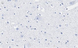 Anti-Neurofilament L Antibody, clone 1E13 ZooMAb® Rabbit Monoclonal recombinant, expressed in HEK 293 cells