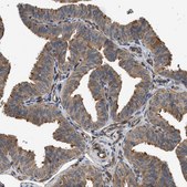 Anti-DUSP14 antibody produced in rabbit Prestige Antibodies® Powered by Atlas Antibodies, affinity isolated antibody, buffered aqueous glycerol solution