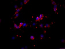 OSUMMER.3 Mouse NRAS-Mutant Melanoma Cell Line